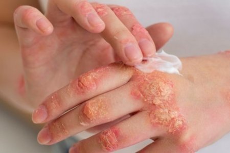 Clinical evaluation and treatment for infectious diseases